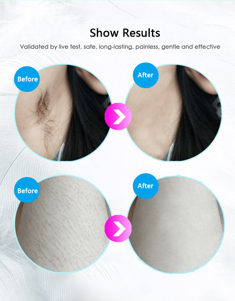Painless Full-Body Hair Removal Device – 8-Week Results | M2K Trends